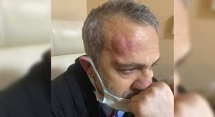 Şanlıurfa Valisinden sağlık çalışanına şiddet açıklaması