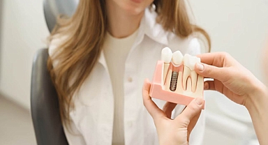 Medicare Dental İmplantları Kapsar mı?