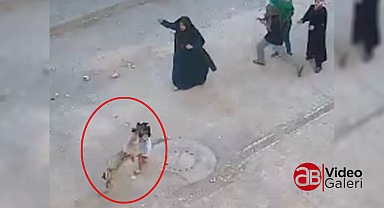 Şanlıurfa'da küçük kız çocuğu köpek saldırısına uğradı