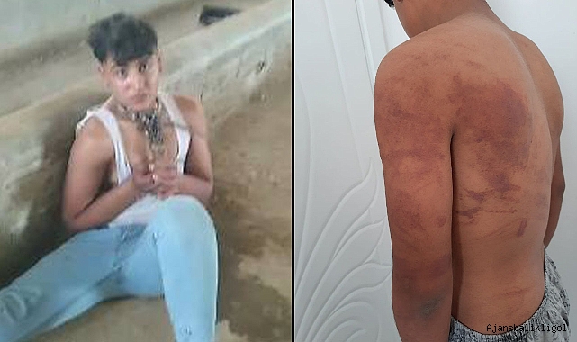 Ahıra zincirle bağlanan çocuk olayında yeni gelişme