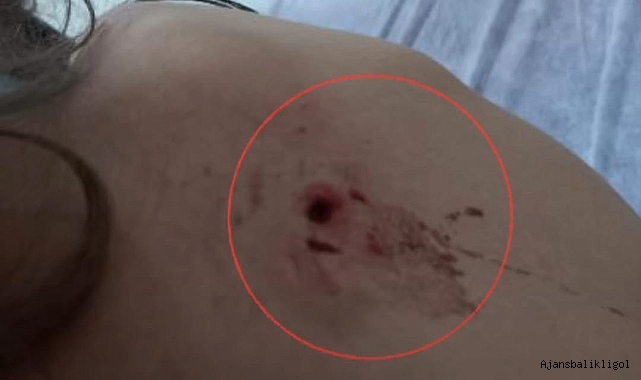 Urfa'da sokak köpekleri çocuğa saldırdı