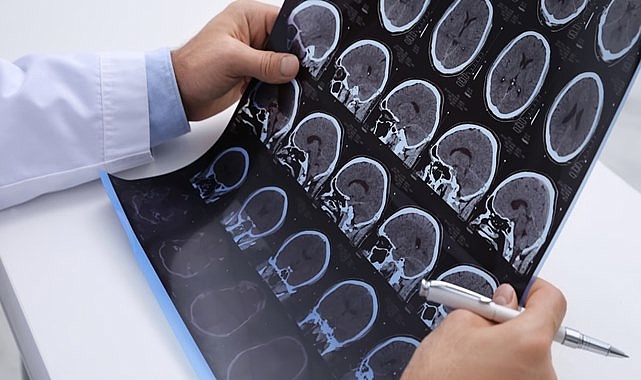 Alzheimer ile ilgili erken şikayetler