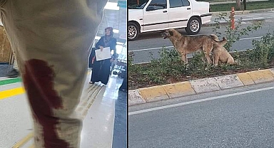 Şanlıurfa’da Bir Kişiyi Yaralayan Köpek Kuduz Çıktı