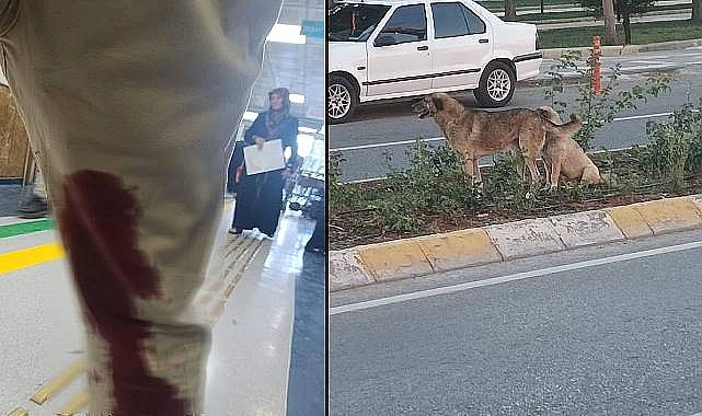 Şanlıurfa’da Bir Kişiyi Yaralayan Köpek Kuduz Çıktı