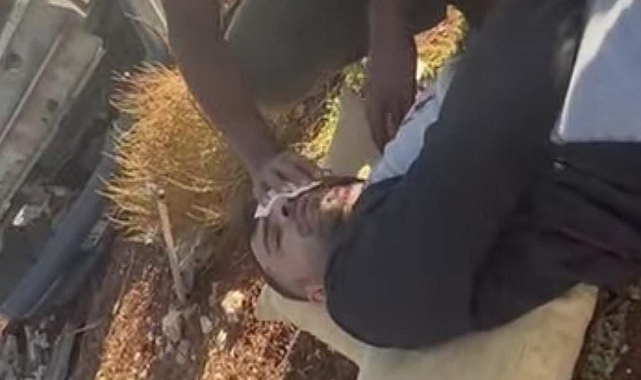Hilvan’da Feci Kaza! 1 Yaralı