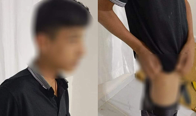 Urfa'da Sokak Köpeği Çocuğu Isırdı