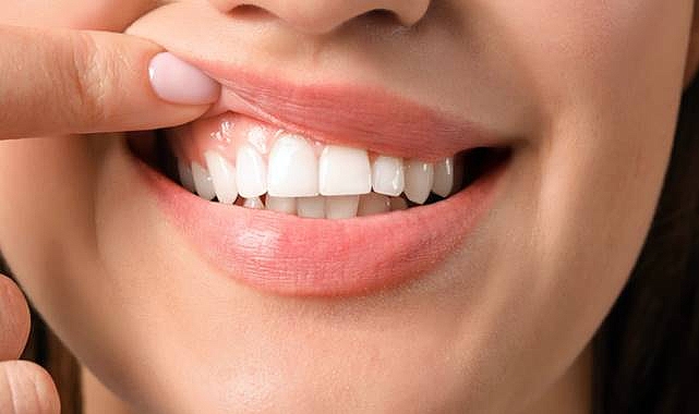 Diş Kanaması Orucu Bozar mı?