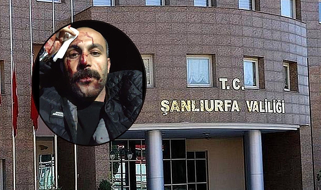 Şanlıurfa Valiliği'nden Avukata Darp Olayı İle İlgili Açıklama! 