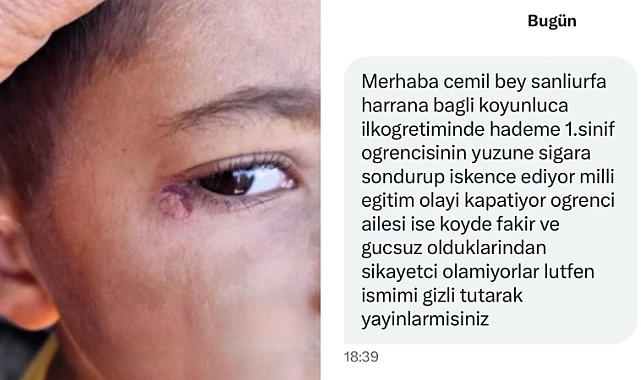 Şanlıurfa’da İddia: Koyunluca İlkokulu’nda Öğrenciye İşkence