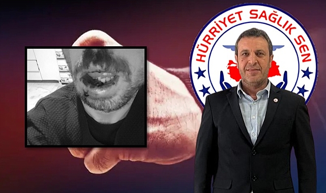 Başkan Bekir Baran: Saldırganın Serbest Bırakılması Kabul Edilemez!