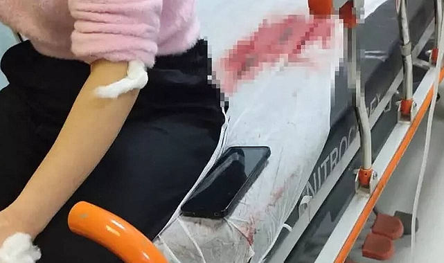 Şanlıurfa’da Eski Görümce Dehşeti: Eski Yenge Hastanelik Oldu