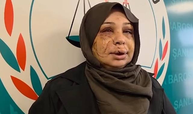 Kadına Şiddet Skandalı: Eşine Şiddet Suçundan Tutuklandı