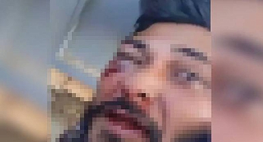 Şanlıurfa’da Sarkıntılık İddiası: Şüpheli Darbedildi