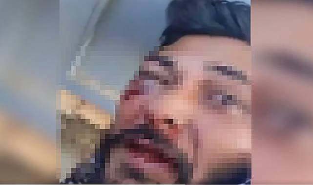Şanlıurfa’da Sarkıntılık İddiası: Şüpheli Darbedildi