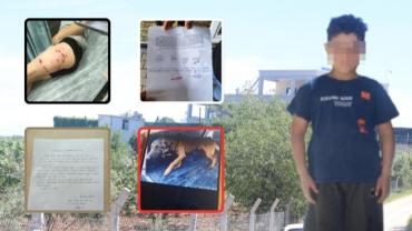 Karaköprü’de Köpek Saldırısı: Küçük Çocuk Ağır Yaralandı